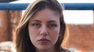 تواجه عاهة دائمة.. رحمة حسن تكشف تفاصيل خطأ طبي أفقدها شعرها