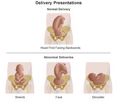 Image result for delivery baby