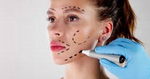 Entenda decisão que considerou ilegal norma sobre harmonização orofacial