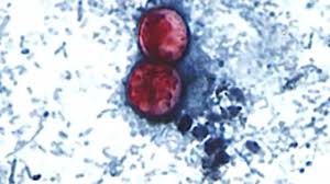 Over 6,100 cyclosporiasis cases tracked in Michigan; boil water advisory for Holly; other stories