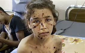 Image result for gaza jpg dead children