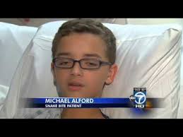 Résultat de recherche d'images pour "copperhead bites"