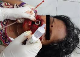 Image result for bomb explosion trauma surgery