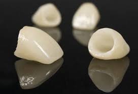 Resultado de imagen para corona dental