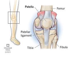 Image of Kneecap bone