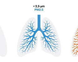 รูปภาพLung affected by PM2.5