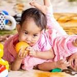 Conjoined Bhutanese twins separated Australia