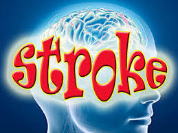 Hasil gambar untuk stroke