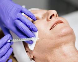 Image of doctor injecting filler into a person's face