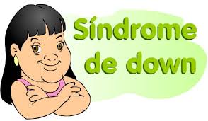 Resultado de imagem para down é normal