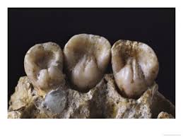 Résultat de recherche d'images pour "shovel shaped incisors"