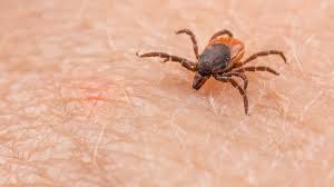 The Unexpected Allergic Reaction: Tick Bite-Induced Red Meat Allergy - 1