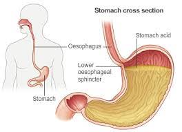 Anant Wellness Care | Gas & Indigestion