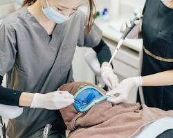 歯科医が患者の歯の冠を鋳造するの画像