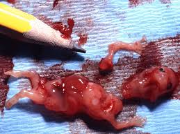 Image result for aborted babies