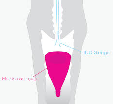 Image result for IUD image