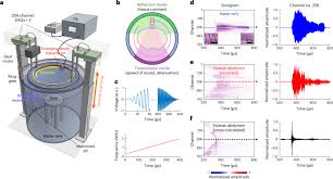 Revolutionizing Medical Imaging: Whole Cross-Sectional Human Ultrasound Tomography