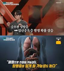 구준엽 서희원 아이콘