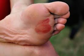 Resultado de imagen de los pies del corredor