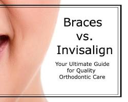 Invisalign aligners being created