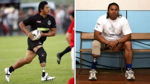 NRL legend reveals his leg was almost BBQ’d