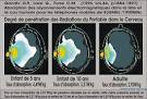 Arrtez de croire que nous naposutilisons que de notre cerveau