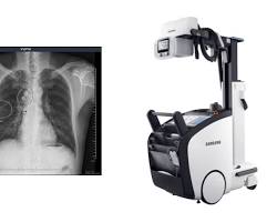 Image of AIPowered Xray Machine