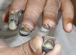 Résultat de recherche d'images pour "krokodil"