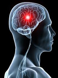 images?q=tbn:ANd9GcQfeA8U4racs9MlmNAIuxRRJ0ASVlTHSE2tx3bcmgTaPr8fkwg4