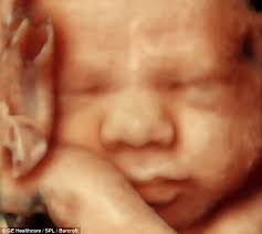 The technology was developed by world renowned Dr Bernard Benoit known for his work on foetal scans - article-2300983-18FD14E8000005DC-802_634x567