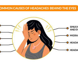 صورة person suffering from severe headache and pain behind the eyes