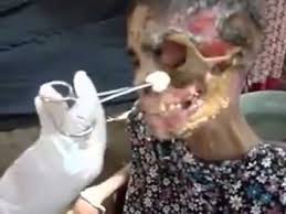 Resultado de imagem para Krokodil