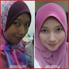 Image result for testimoni esp shaklee untuk kulit