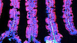  Leaky Gut Lets Bacteria Slip Away and Stir Up Autoimmunity
