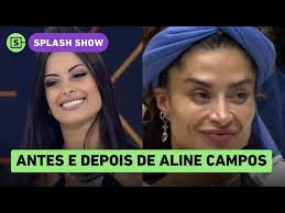 Como era o rosto de Aline Campos antes do BBB? Fotos revelam transformação