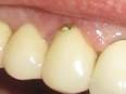 Behandlungsfehler: Zahnärzte und Pflegeheime pfuschen am