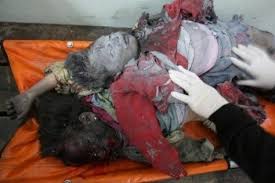 Image result for children palestine slaughtered