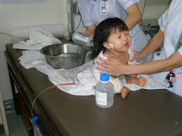 Image result for kidney surgery         girl