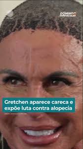 Gretchen aparece careca e expõe luta contra alopecia #Shorts #DomingoEspetacular