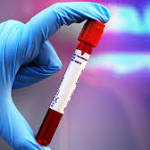  First blood test to help diagnose traumatic brain injuries gets FDA approval
