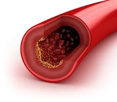 Image result for Cholesterol