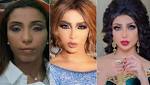 دنيا بطمة: لم أخضع لعمليات