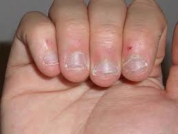 Image result for biting nails after manicure