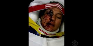 Image result for takata recall