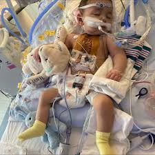 Caden was born in April 2023 with TGA, VSD and pulmonary ...