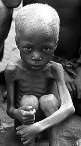 Image result for starving people