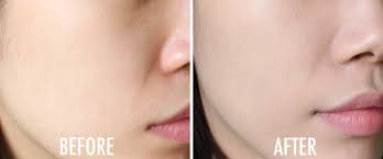 Image result for atomy sunscreen