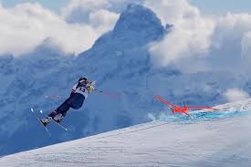 Lindsey Vonn is in 'stable condition' after surgery to repair fracture from crash in women's downhill
