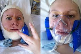 Image result for jaw surgery