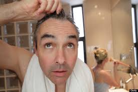 Hairloss Cure: Could Follica Be A New Breakthrough In Baldness Prevention Products? - o-BALDNESS-570